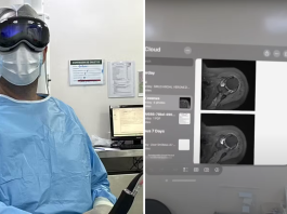 Brazilian doctor uses Vision Pro for a surgery (1)